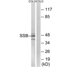 Western Blot - Anti-SSB Antibody (B1181) - Antibodies.com