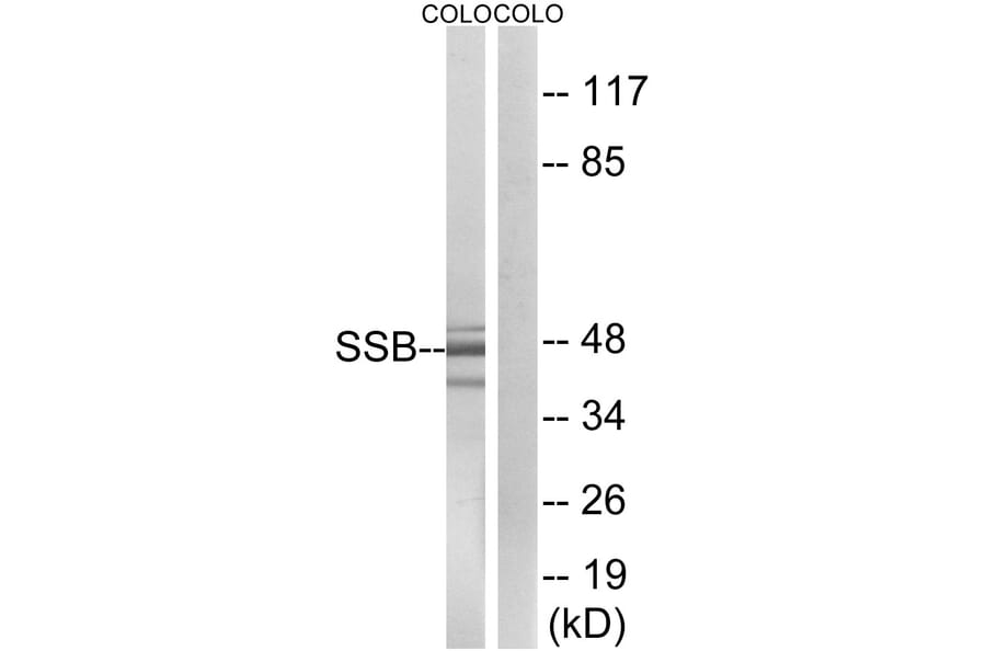 Western Blot - Anti-SSB Antibody (B1181) - Antibodies.com