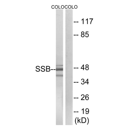 Western Blot - Anti-SSB Antibody (B1181) - Antibodies.com