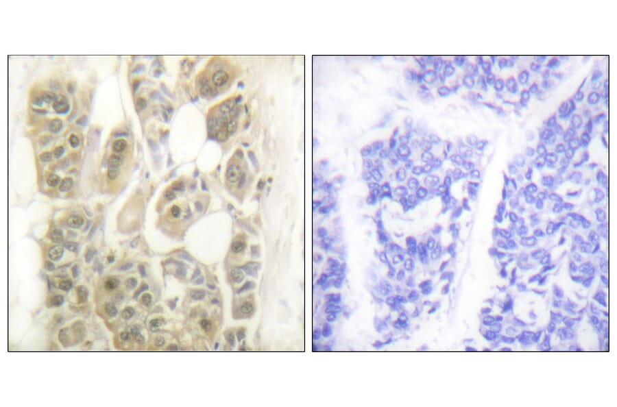 Immunohistochemistry - Anti-SSB Antibody (B1181) - Antibodies.com