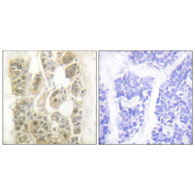 Immunohistochemistry - Anti-SSB Antibody (B1181) - Antibodies.com