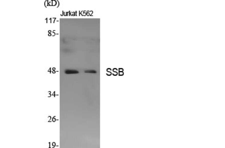 Western Blot - Anti-SSB Antibody (B1181) - Antibodies.com