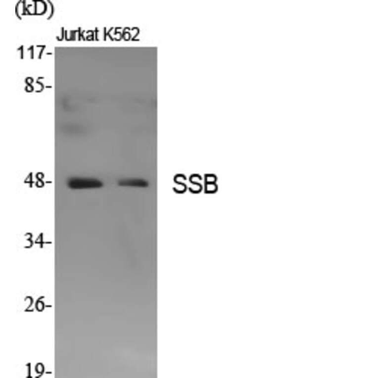 Western Blot - Anti-SSB Antibody (B1181) - Antibodies.com