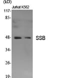 Western Blot - Anti-SSB Antibody (B1181) - Antibodies.com