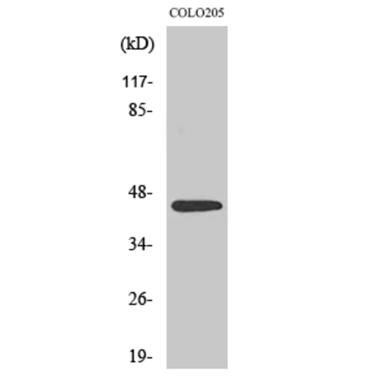 Western Blot - Anti-SSB Antibody (B1181) - Antibodies.com