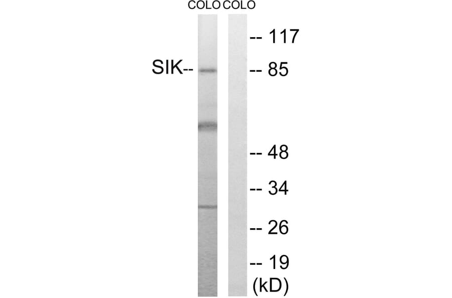 Western Blot - Anti-SIK Antibody (B8185) - Antibodies.com