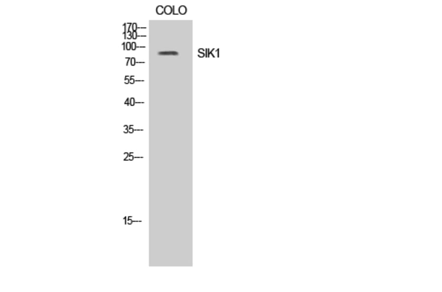 Western Blot - Anti-SIK Antibody (B8185) - Antibodies.com