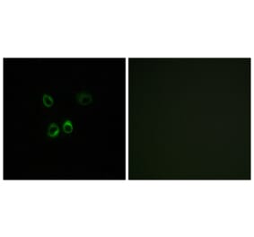 Immunofluorescence - Anti-RGR Antibody (G737) - Antibodies.com