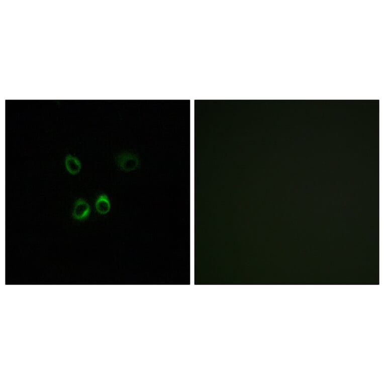 Immunofluorescence - Anti-RGR Antibody (G737) - Antibodies.com