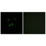 Immunofluorescence - Anti-RGR Antibody (G737) - Antibodies.com