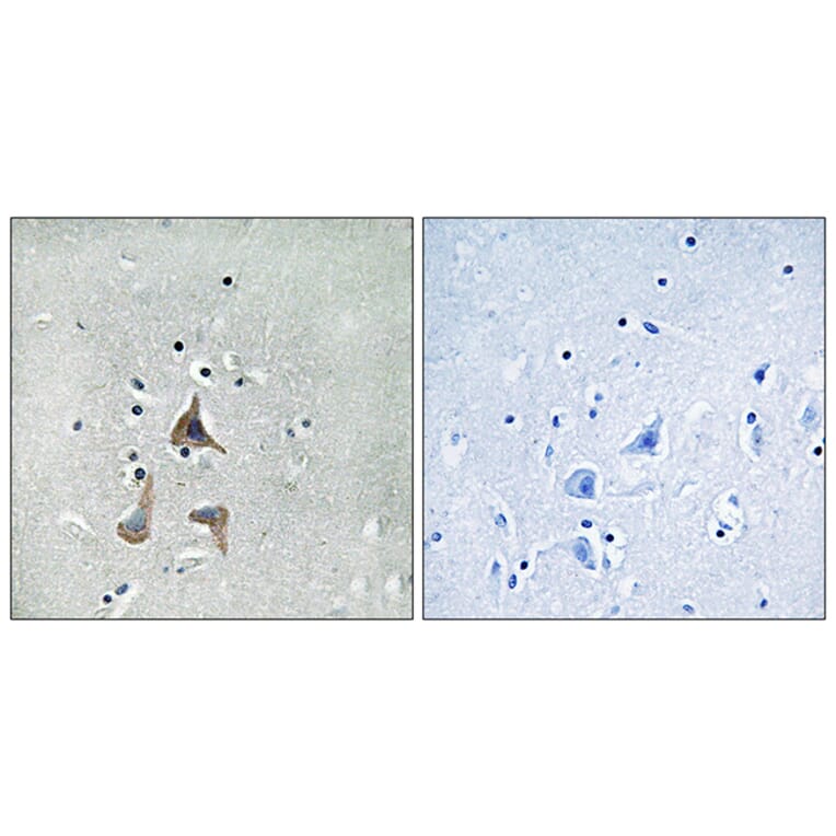 Immunohistochemistry - Anti-RGR Antibody (G737) - Antibodies.com