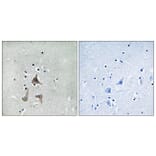 Immunohistochemistry - Anti-RGR Antibody (G737) - Antibodies.com