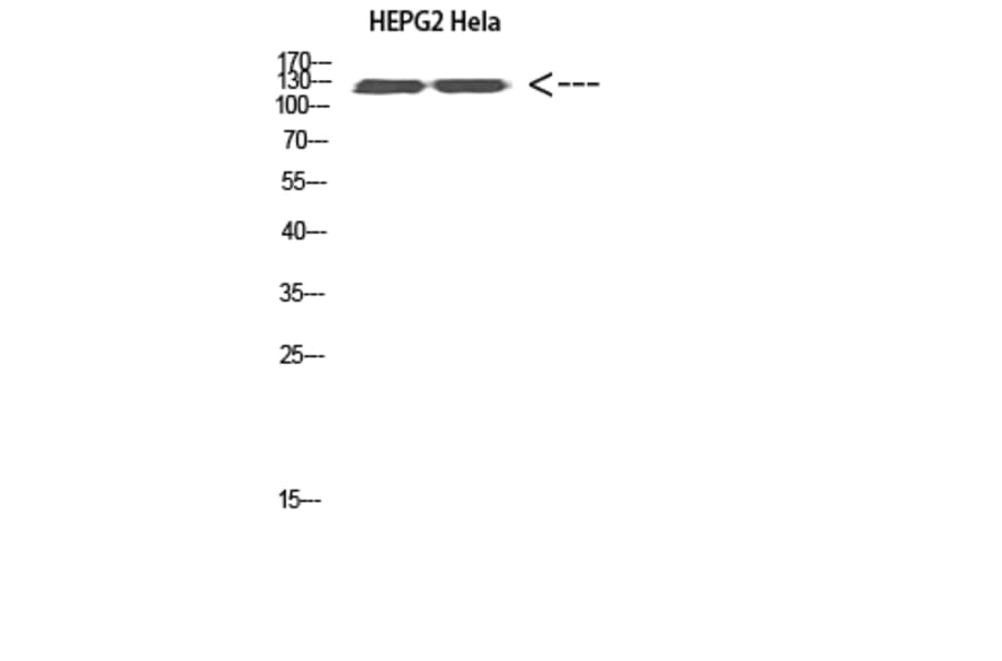 Western Blot - Anti-RET Antibody (C30856) - Antibodies.com