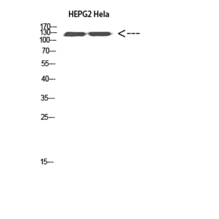 Western Blot - Anti-RET Antibody (C30856) - Antibodies.com