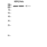 Western Blot - Anti-RET Antibody (C30856) - Antibodies.com