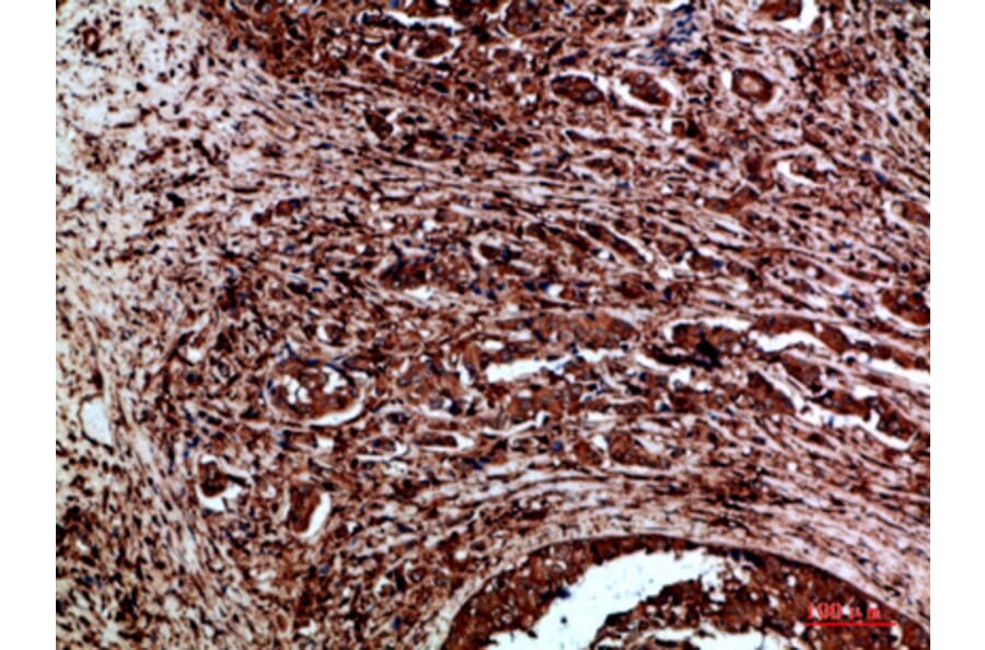 Immunohistochemistry - Anti-RET Antibody (C30856) - Antibodies.com
