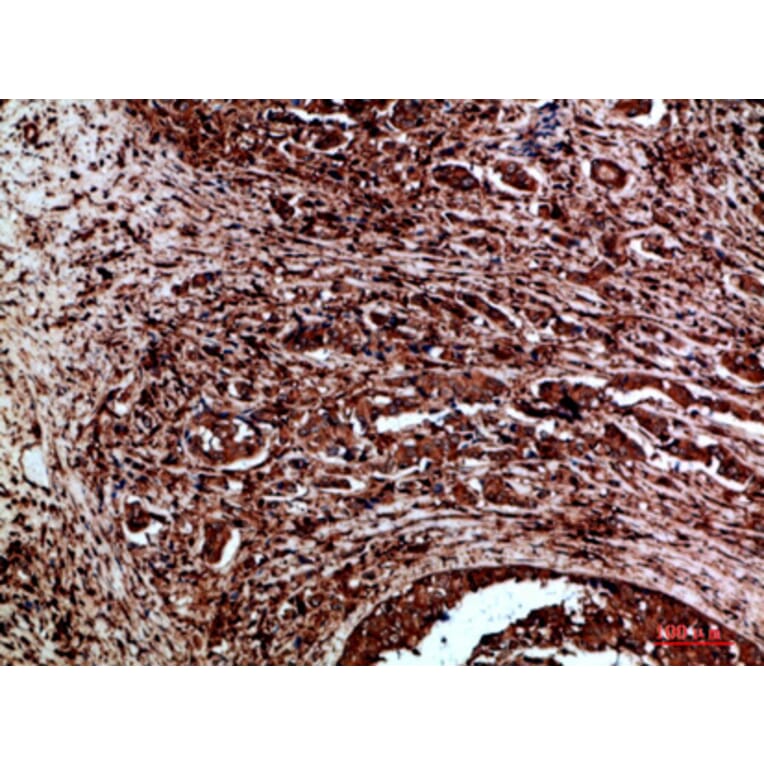 Immunohistochemistry - Anti-RET Antibody (C30856) - Antibodies.com