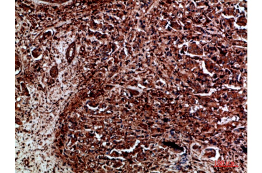 Immunohistochemistry - Anti-RET Antibody (C30856) - Antibodies.com
