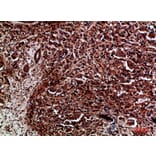 Immunohistochemistry - Anti-RET Antibody (C30856) - Antibodies.com