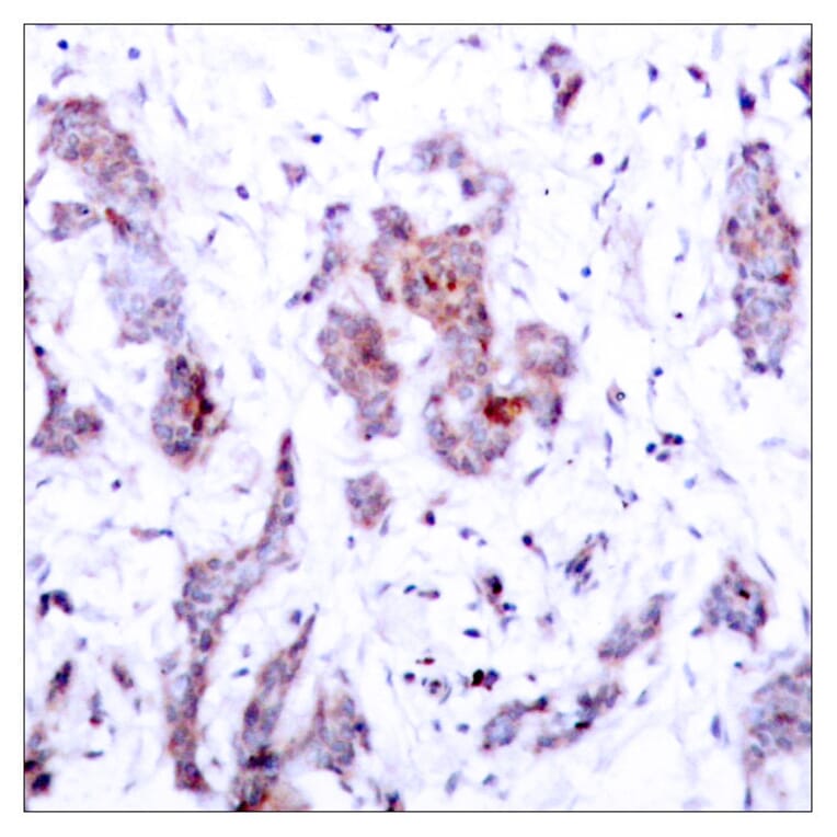 Immunohistochemistry - Anti-Rel Antibody (B7211) - Antibodies.com