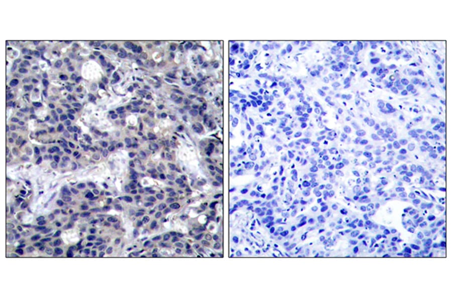 Immunohistochemistry - Anti-PKR Antibody (B7198) - Antibodies.com