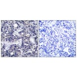 Immunohistochemistry - Anti-PKR Antibody (B7198) - Antibodies.com