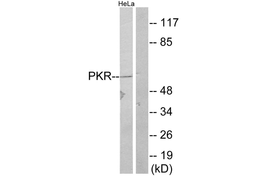 Western Blot - Anti-PKR Antibody (B7198) - Antibodies.com