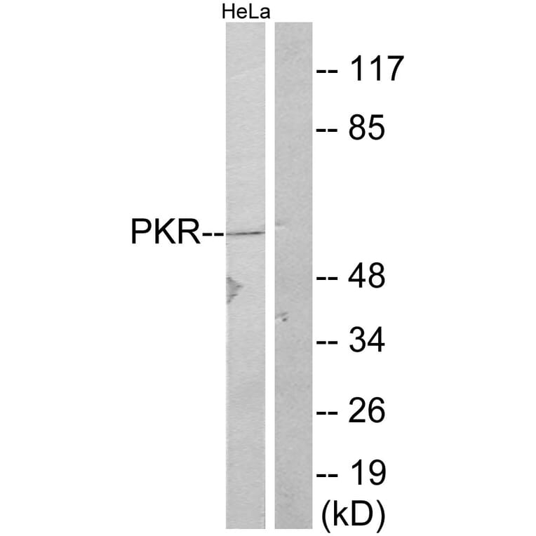 Western Blot - Anti-PKR Antibody (B7198) - Antibodies.com