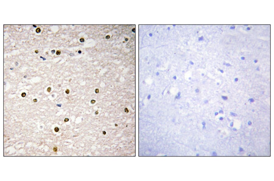 Immunohistochemistry - Anti-p73 Antibody (C10080) - Antibodies.com