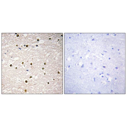 Immunohistochemistry - Anti-p73 Antibody (C10080) - Antibodies.com