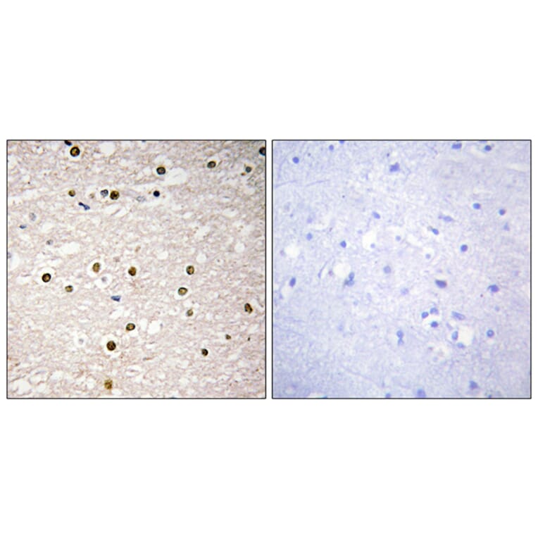 Immunohistochemistry - Anti-p73 Antibody (C10080) - Antibodies.com
