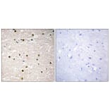 Immunohistochemistry - Anti-p73 Antibody (C10080) - Antibodies.com