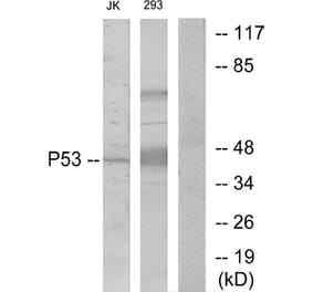 Western Blot - Anti-p53 Antibody (B7185) - Antibodies.com
