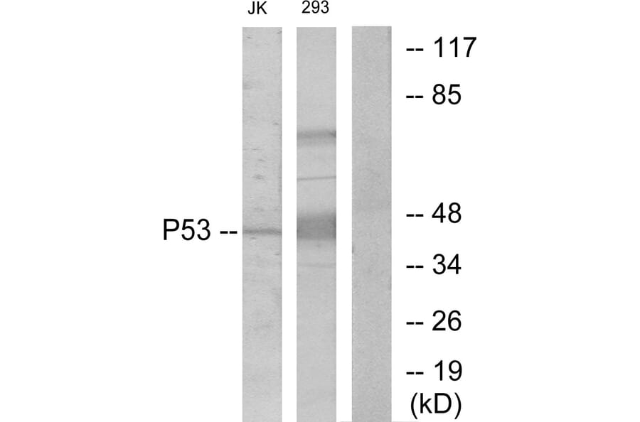 Western Blot - Anti-p53 Antibody (B7185) - Antibodies.com