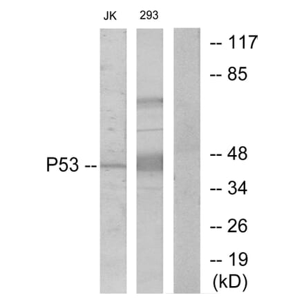 Western Blot - Anti-p53 Antibody (B7185) - Antibodies.com