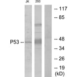 Western Blot - Anti-p53 Antibody (B7185) - Antibodies.com