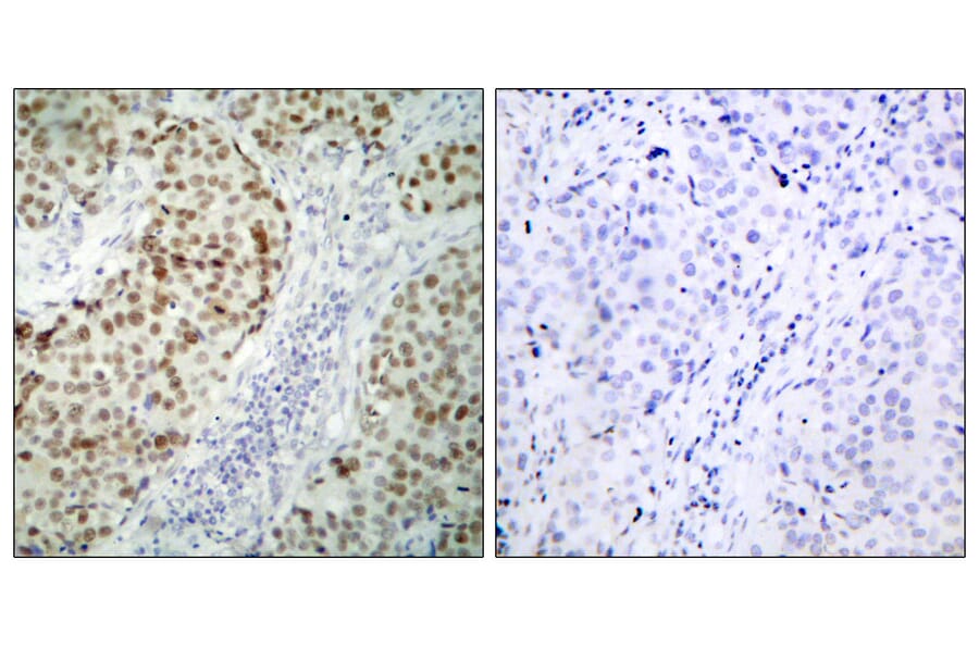 Immunohistochemistry - Anti-p53 Antibody (B7185) - Antibodies.com