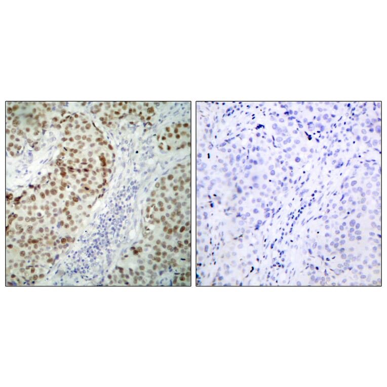 Immunohistochemistry - Anti-p53 Antibody (B7185) - Antibodies.com