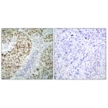Immunohistochemistry - Anti-p53 Antibody (B7185) - Antibodies.com