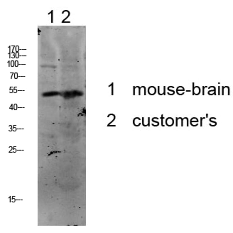 Western Blot - Anti-p53 Antibody (B7185) - Antibodies.com