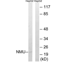 Western Blot - Anti-NMU Antibody (C16975) - Antibodies.com