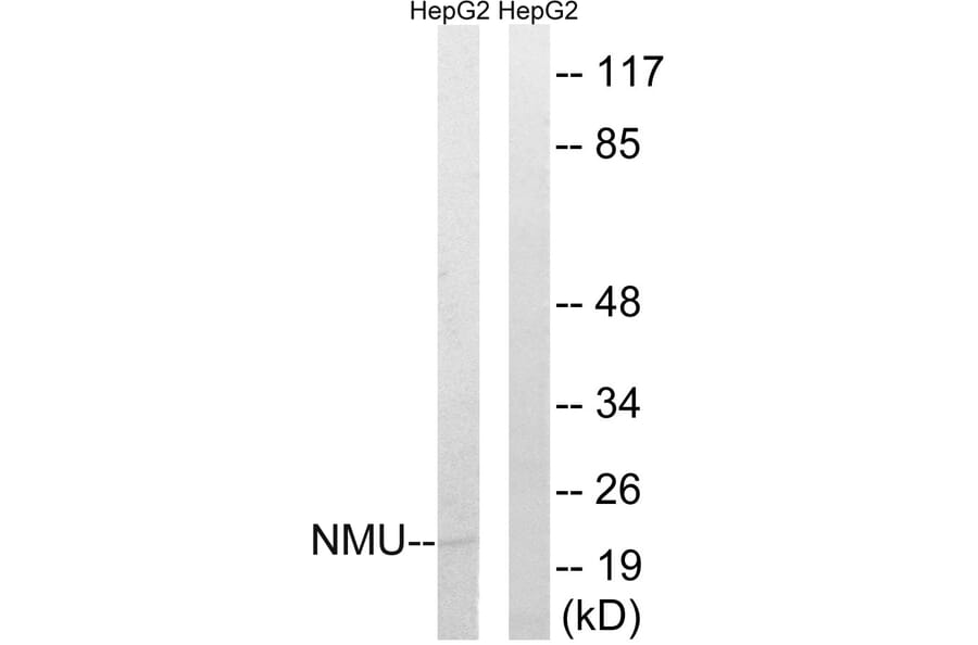Western Blot - Anti-NMU Antibody (C16975) - Antibodies.com