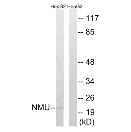 Western Blot - Anti-NMU Antibody (C16975) - Antibodies.com