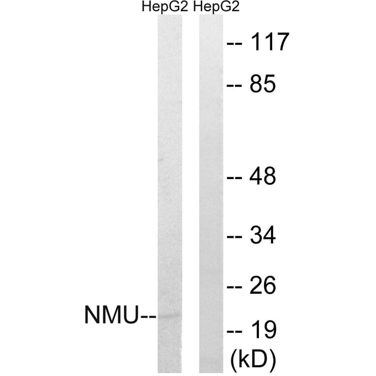 Western Blot - Anti-NMU Antibody (C16975) - Antibodies.com