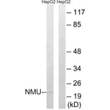 Western Blot - Anti-NMU Antibody (C16975) - Antibodies.com