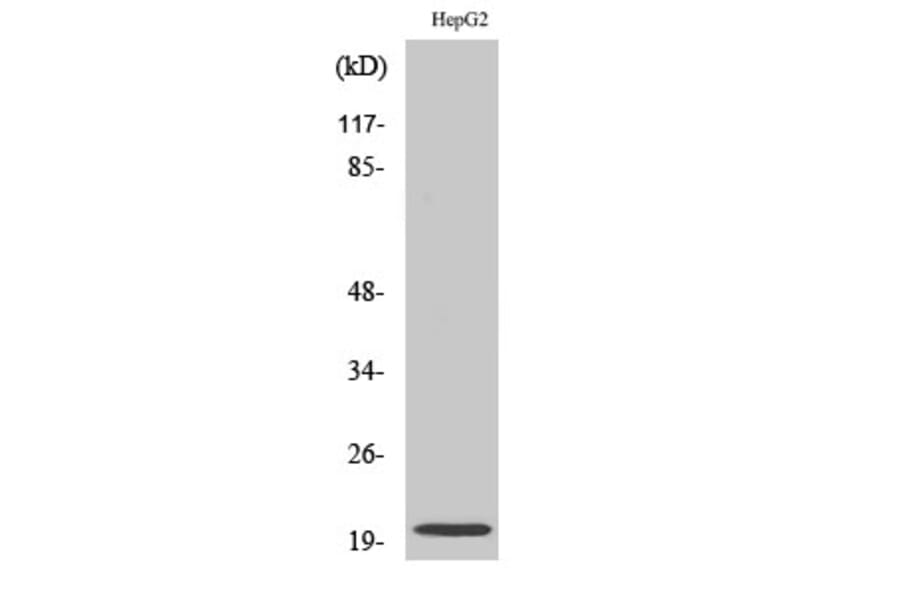 Western Blot - Anti-NMU Antibody (C16975) - Antibodies.com