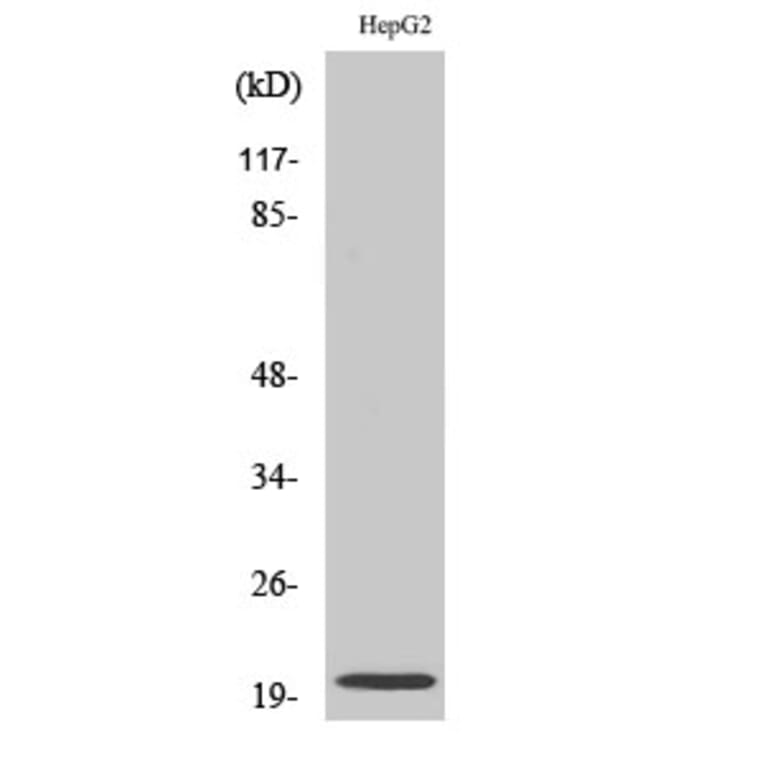 Western Blot - Anti-NMU Antibody (C16975) - Antibodies.com