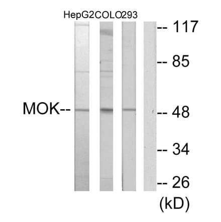 Western Blot - Anti-MOK Antibody (C11907) - Antibodies.com