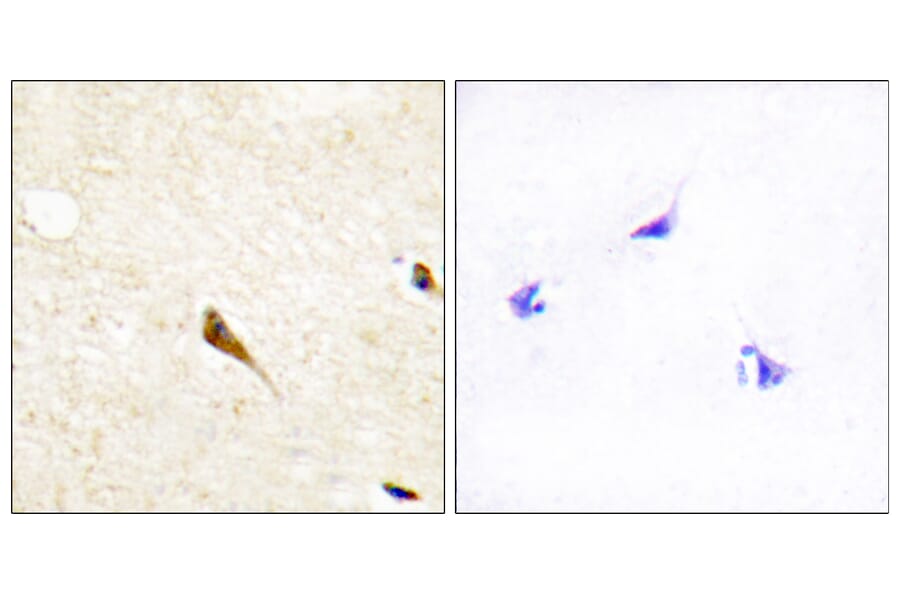 Immunohistochemistry - Anti-MOK Antibody (C11907) - Antibodies.com