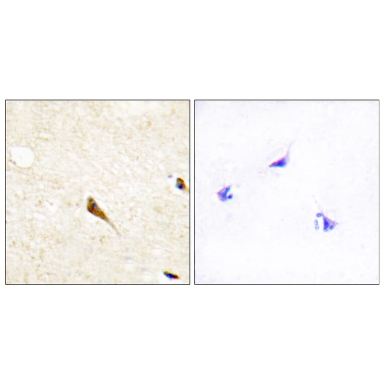 Immunohistochemistry - Anti-MOK Antibody (C11907) - Antibodies.com